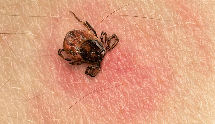 Effective Home Remedies for Tick Removal: A Simple Guide